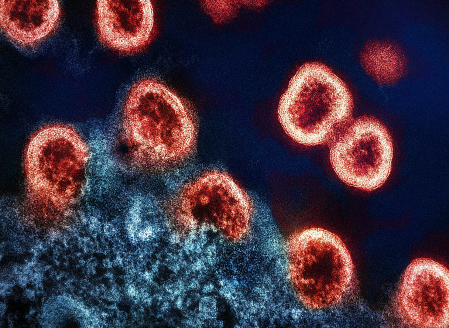HIV-1 Virus Particles Transmission electron micrograph of HIV-1 virus particles (colorized red) replicating from an HIV-infected H9 T-cell (blue). Image captured at the NIAID Integrated Research Facility (IRF) in Fort Detrick, Maryland. Credit: NIAID https://www.flickr.com/photos/niaid/52955756878/ | © Unsplash / National Institute of Allergy and Infectious Diseases